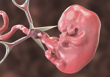 Spina Bifida Pada Bayi