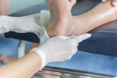 Cara Tepat Merawat Luka Diabetes Agar Tidak Infeksi