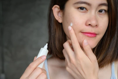 Manfaat Clindamycin Ternyata Bisa Sebagai Obat Jerawat
