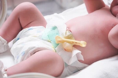 Begini Cara Benar Merawat Tali Pusat Bayi Baru Lahir