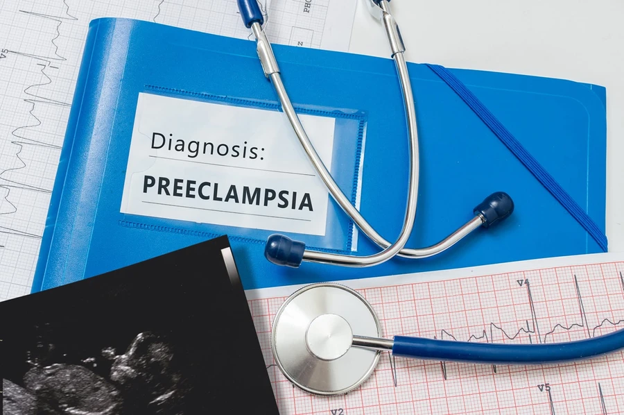 Waspadai Gejala Preeklampsia pada Ibu Hamil