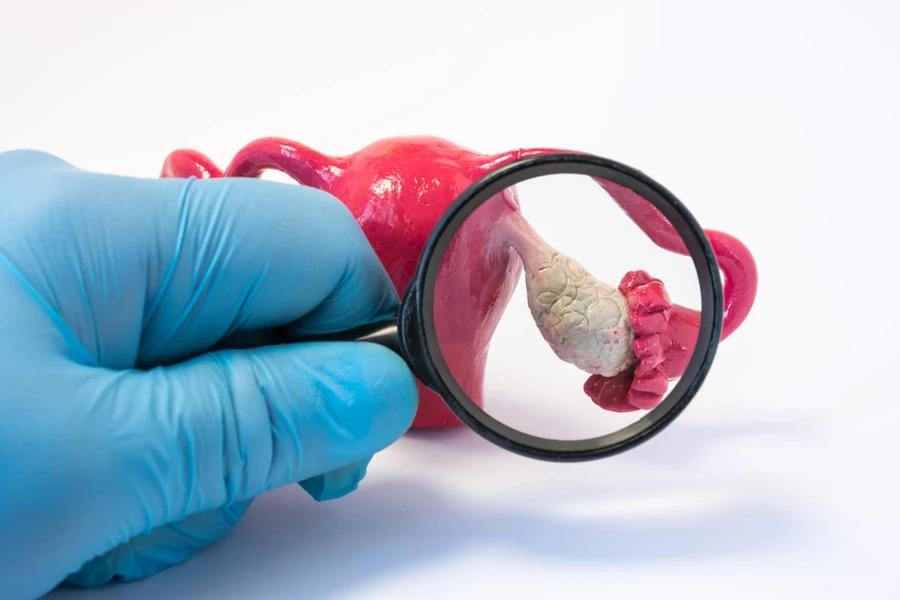 Memahami PCOS