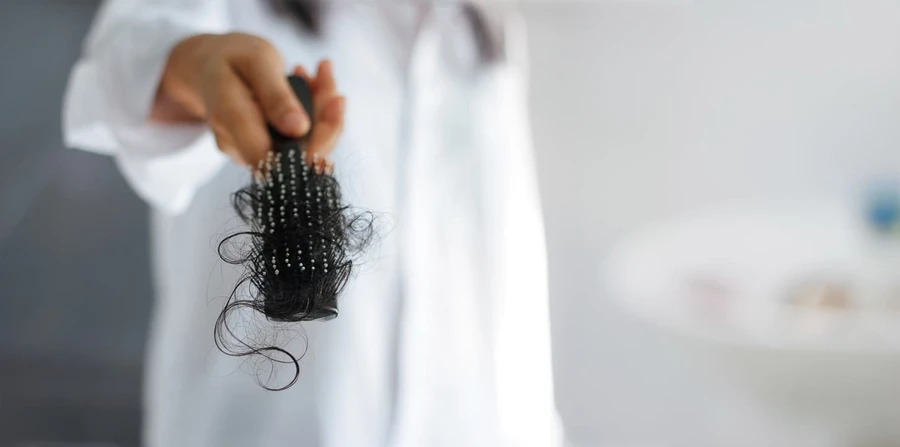 Ketahui Apa Saja Penyebab Rambut Bisa Rontok 