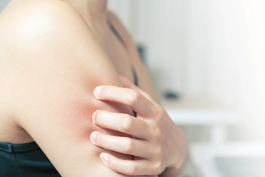 Sederet Gangguan Kulit Akibat Diabetes
