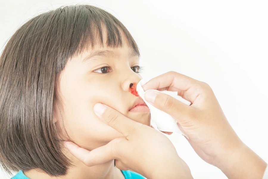 6 Penyebab Mimisan Pada Anak & Penanganan