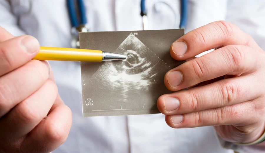 Penyakit Jantung Bawaan (PJB) Pada Bayi