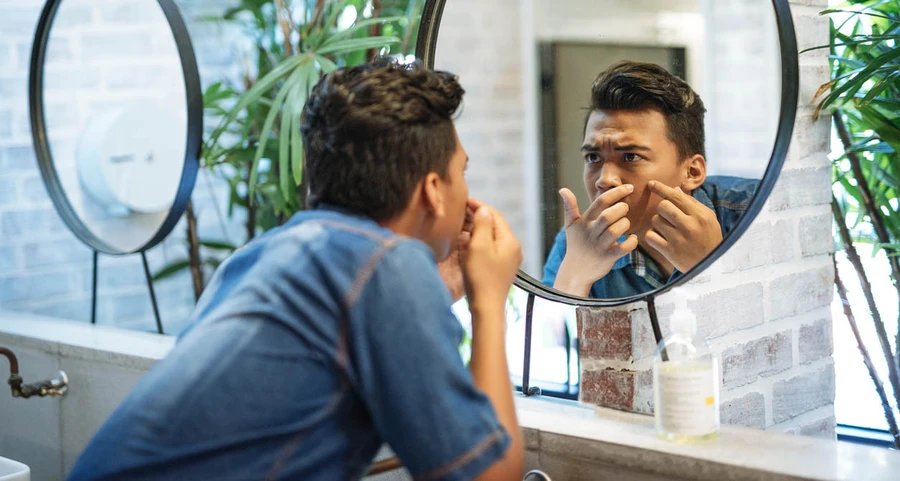 Mengenal Jenis-Jenis Jerawat Beserta Pengobatannya