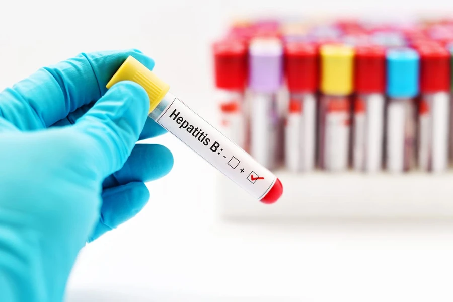 Pengobatan Hepatitis B, Obat Rumahan Hingga Cangkok Hati