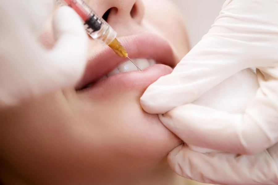 Mau Sulam Bibir? Ketahui Dulu Efek Sampingnya