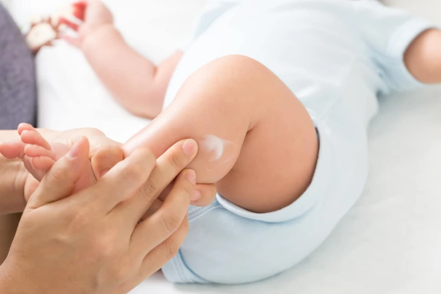 Masalah Kulit Bayi Yang Perlu Anda Waspadai