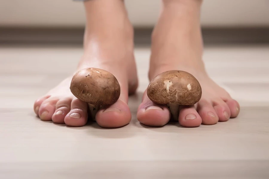 Jamur Penyebab Bau Kaki - Definisi, Gejala, & Cara Mengatasinya