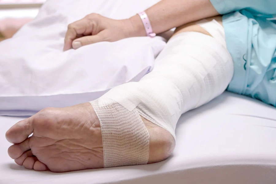Awasi Terjadi Gas Gangrene, Pahami Gejala-Gejalanya