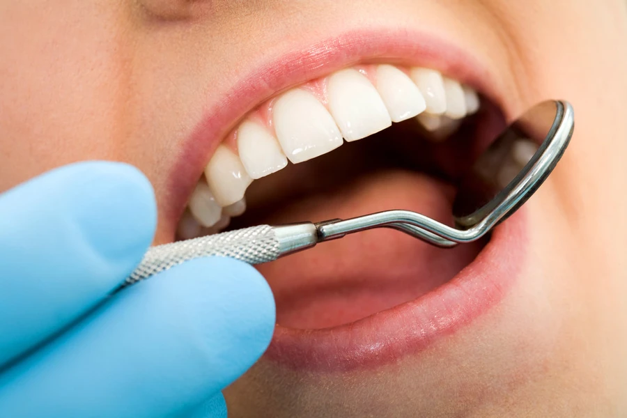 5 Jenis Tambal Gigi Paling Umum di Dokter Gigi