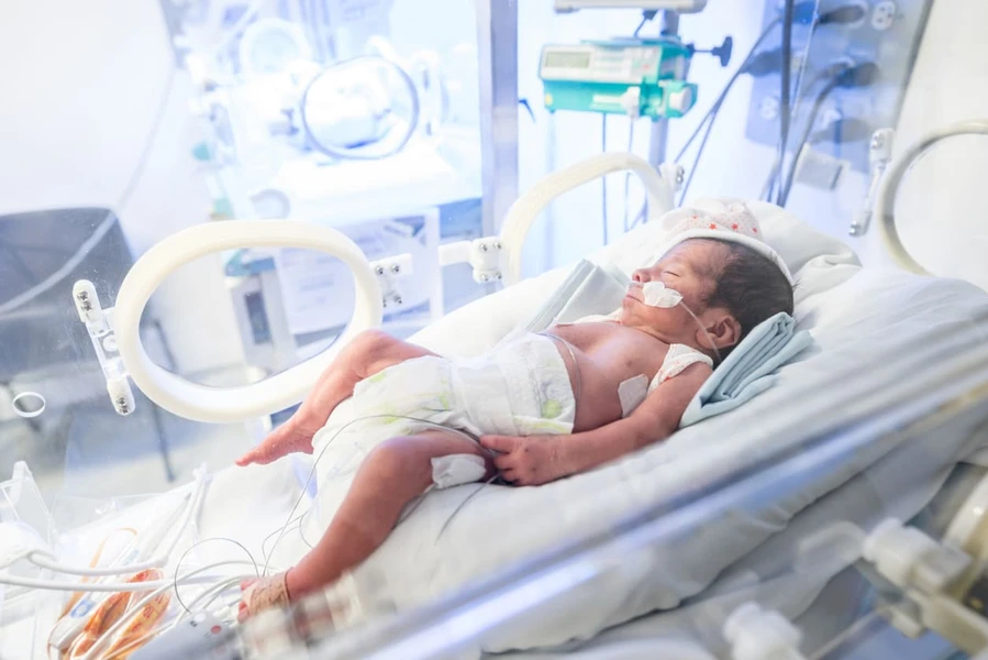 Birth Asphyxia Pada Anak: Penyebab, Gejala, dan Obat