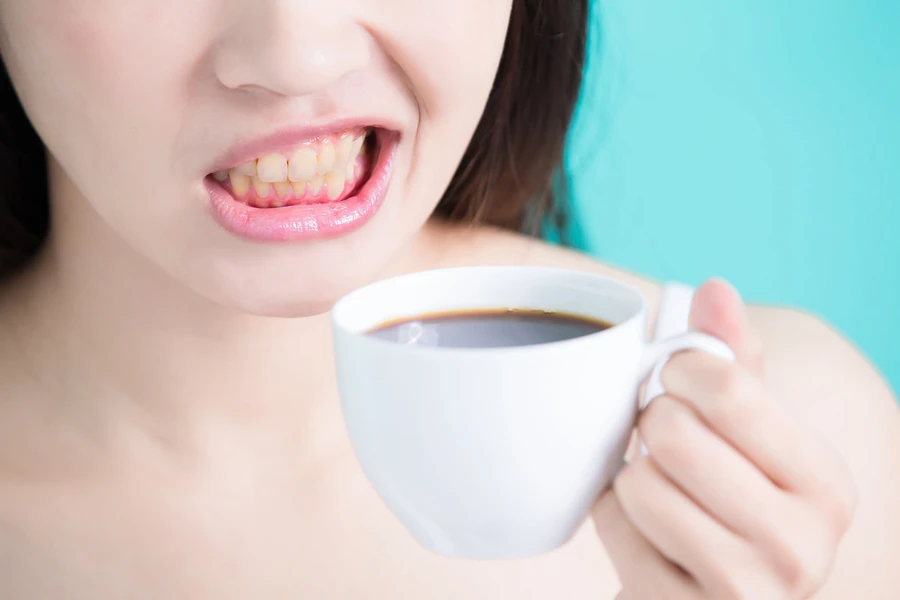 Tak Hanya Bikin Gigi Kuning, Ini Efek Kopi Pada Kesehatan Gigi