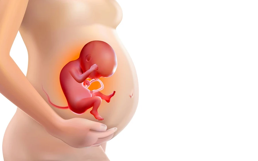 Stroke bayi dalam kandungan - Penyebab, Gejala, & Pengobatan