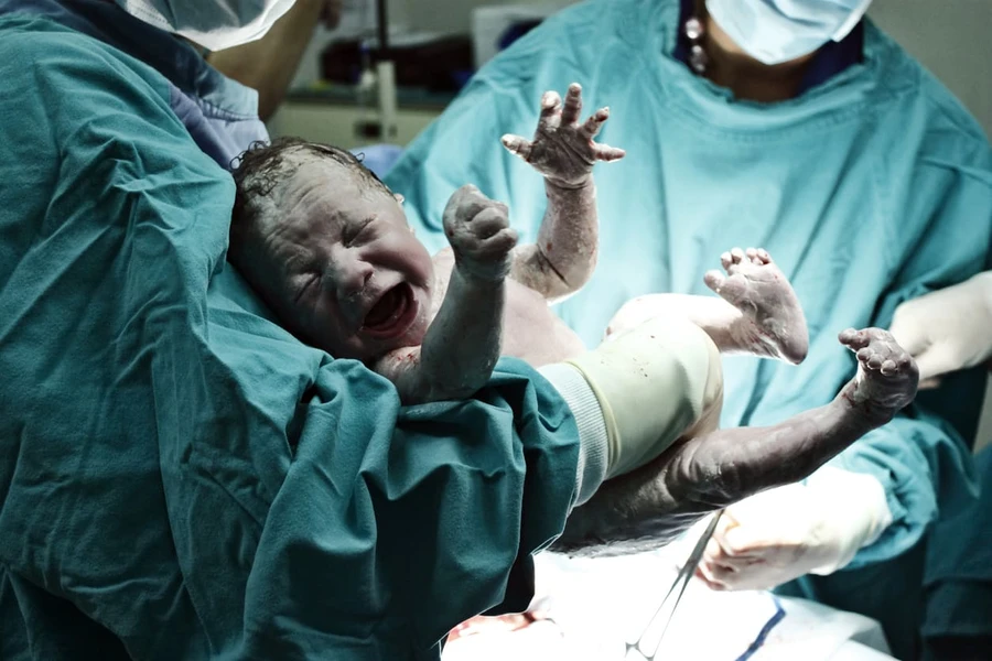 Gastroschisis Pada Anak: Penyebab, Gejala, dan Obat