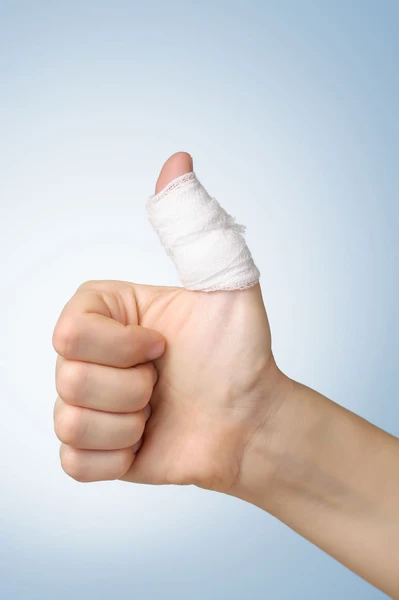 Jangan Tunggu Sampai Parah, Begini 9 Pengobatan Cedera Jari Tangan