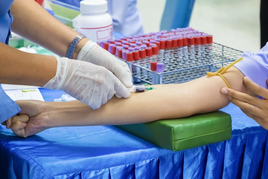 Cara Penularan HIV dengan Cara yang Tidak Terduga