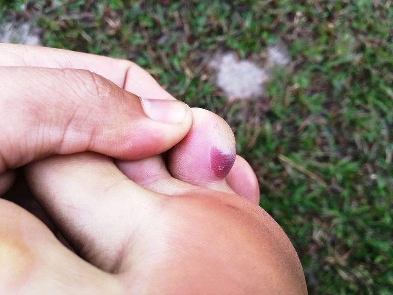 Reaksi Vaksin Pada Anak: Penyebab, Gejala, dan Obat