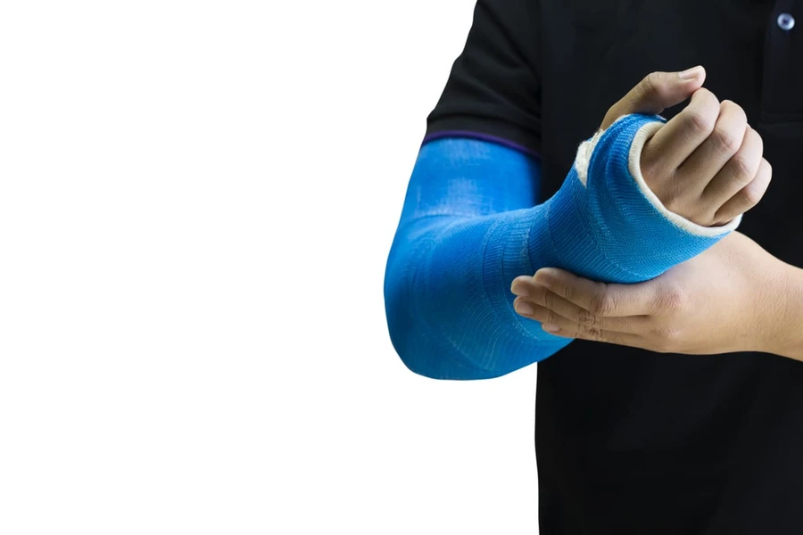 Begini Cara Merawat Gips yang Benar Ketika Anda Patah Tulang