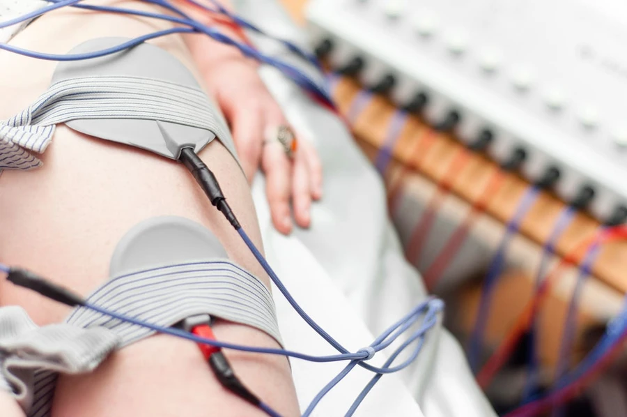 Mengenal Terapi Listrik untuk Penanganan Stroke