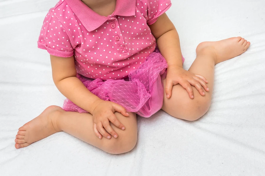 Anak yang Lahir dengan Kaki Bengkok, Apakah Bisa Disembuhkan?