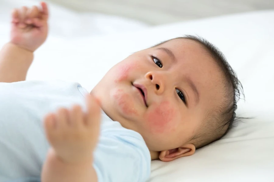 Inilah Tanda-Tanda Bayi Tidak Cocok Susu Formula dan Cara Mengatasinya