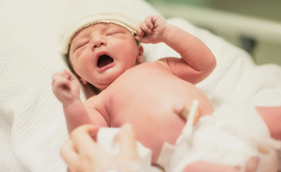 Umbilical Granuloma pada Bayi Baru Lahir