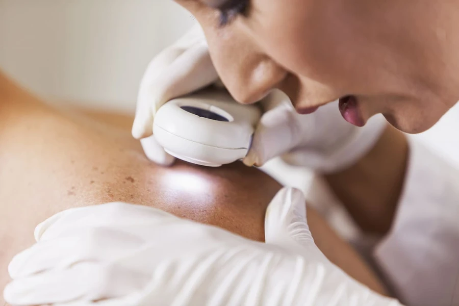 Bagaimana Tumor Jinak Bisa Mengganas Jadi Kanker Usus Besar?