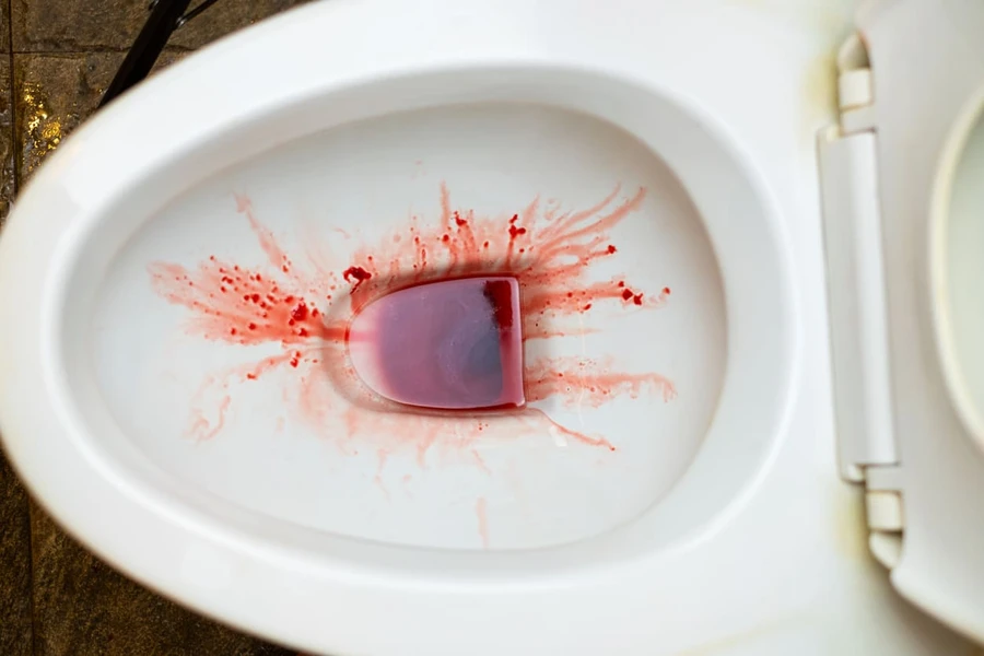 Pemberian Obat Kencing Darah Harus Sesuai Dengan Penyebab