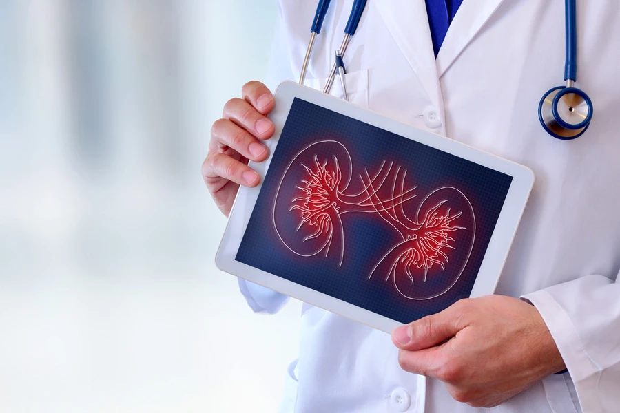 Pahami Gejala Uremia Sejak Dini Agar Tak Berujung Komplikasi