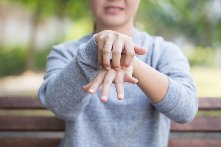 Ada Infeksi Jamur di Tangan? Waspada Gejala Tinea Manum