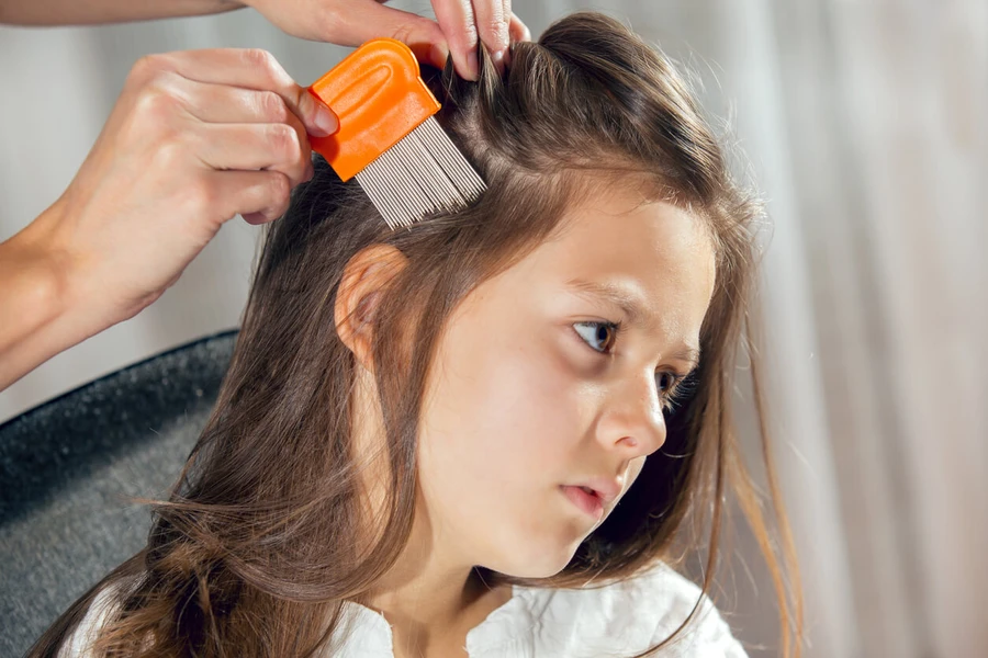 Tak Hanya Bikin Gatal, Ini 5 Bahaya Kutu Rambut Bila Dibiarkan