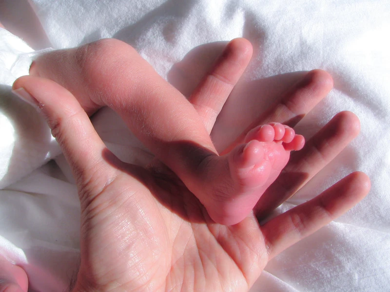 Dampak Kekurangan Vitamin D Pada Bayi, Anak, dan Dewasa