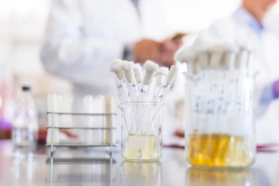3 Proses Pembentukan Urine dalam Tubuh