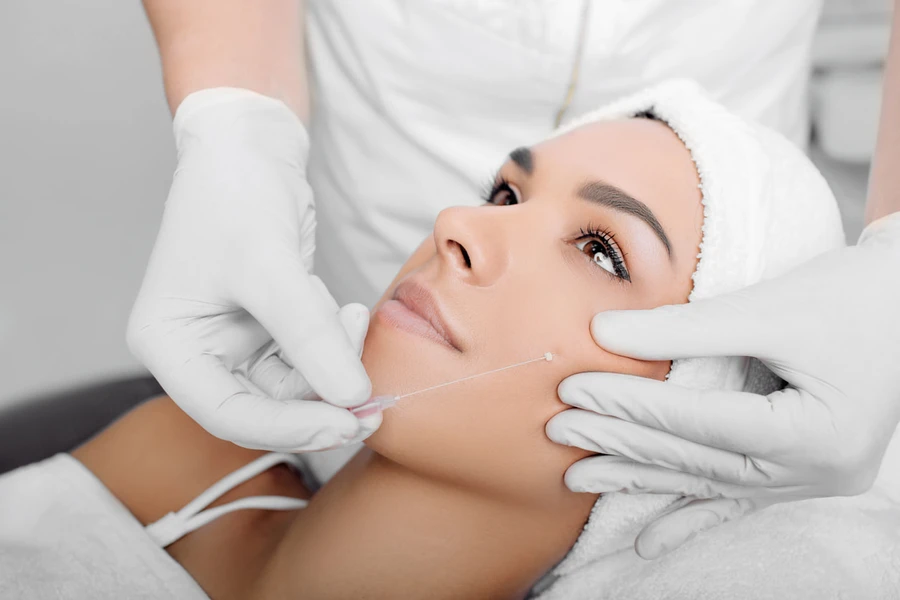 6 Perbedaan Threadlift Mono dan Cog, Pahami Sebelum Memilih