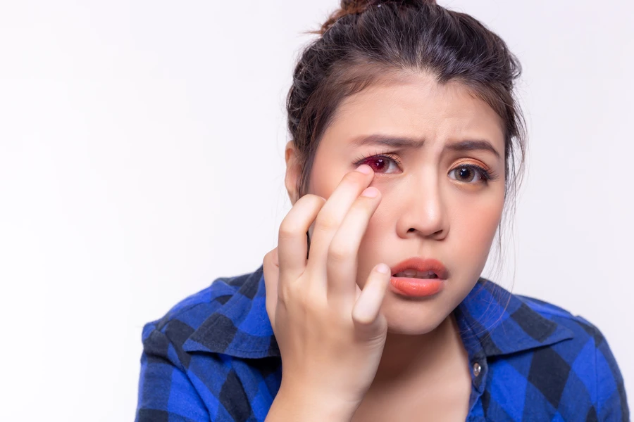 Begini Cara Tepat Menggunakan Terramycin sebagai Salep Mata