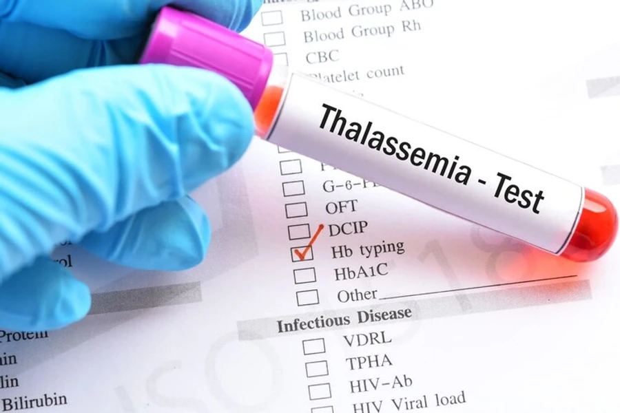 Jenis-jenis Thalasemia Berdasarkan Keparahan Gejala