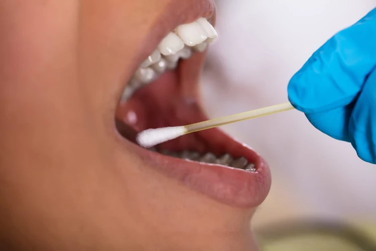Penyakit Gigi dan Mulut Tingkatkan Risiko Kanker Payudara