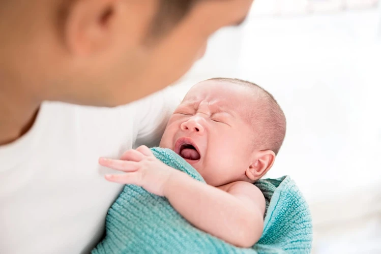 Gumoh Pada Bayi: Penyebab dan Cara Mengatasinya
