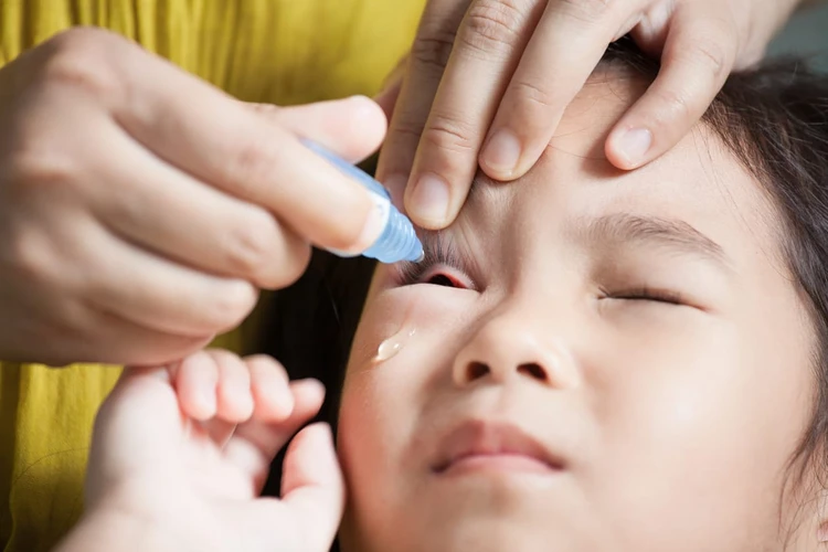 Hati-Hati Memilih Obat Sakit Mata untuk Bayi dan Anak