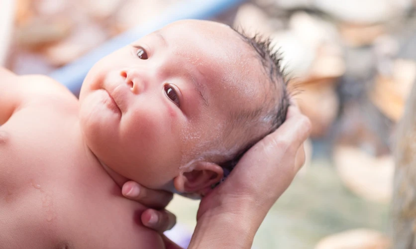 1001 Penyebab Rambut Bayi Rontok dan Cara Mengatasinya