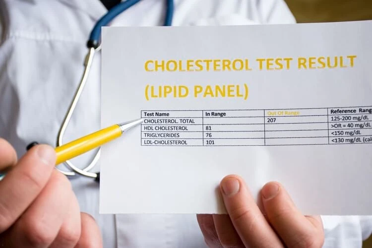 Apa Itu HDL yang Dikenal Sebagai Kolesterol Baik?