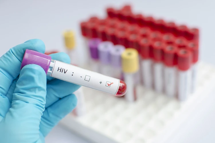 Inilah Bagian Tubuh Yang Diserang HIV Hingga Berakibat Fatal