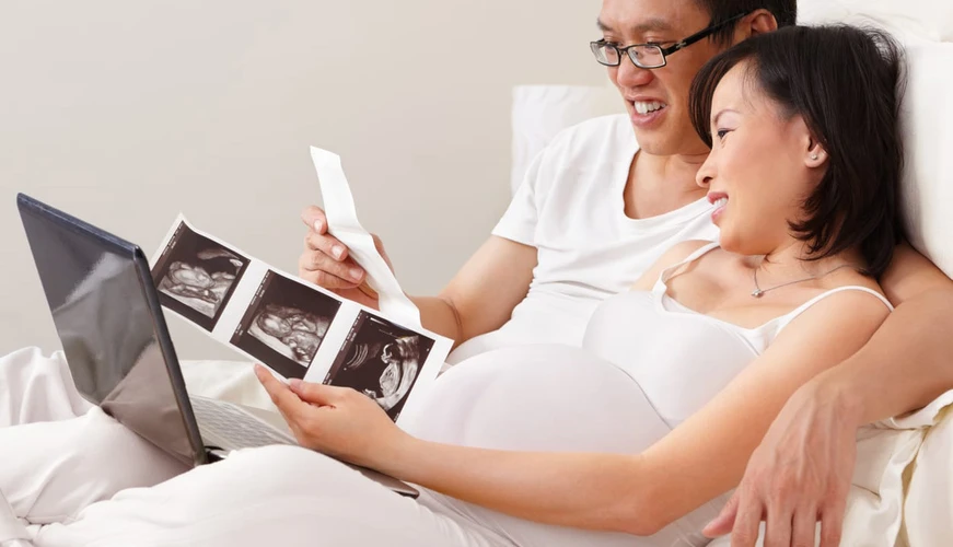 Berapa Biaya USG 4 Dimensi untuk Kehamilan?