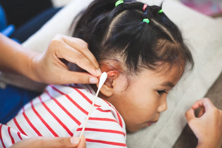 Telinga Anak Berdarah, Apa yang Harus Dilakukan?