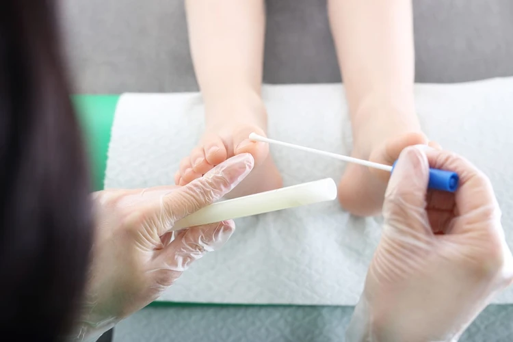 Seputar Tes Pap Smear yang Harus Anda Ketahui