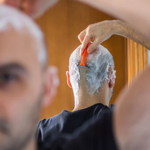 Ketahui 8 Tips Perawatan Ini Untuk Kepala Botak 
