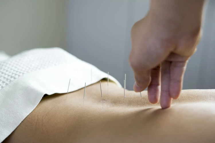 Akupunktur Hingga Hipnosis, Ragam Metode Stop Kebiasaan Merokok